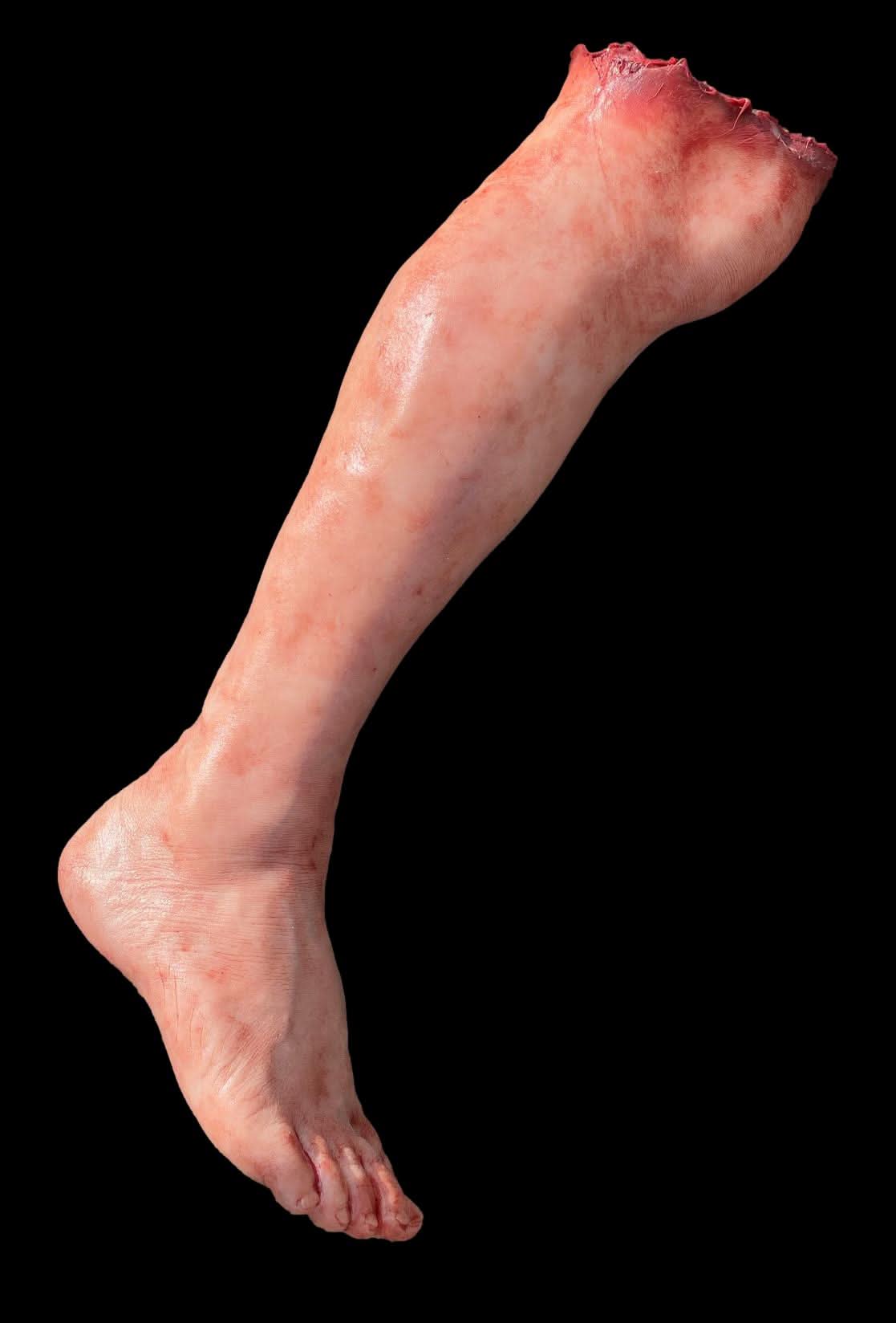 Thumb 2