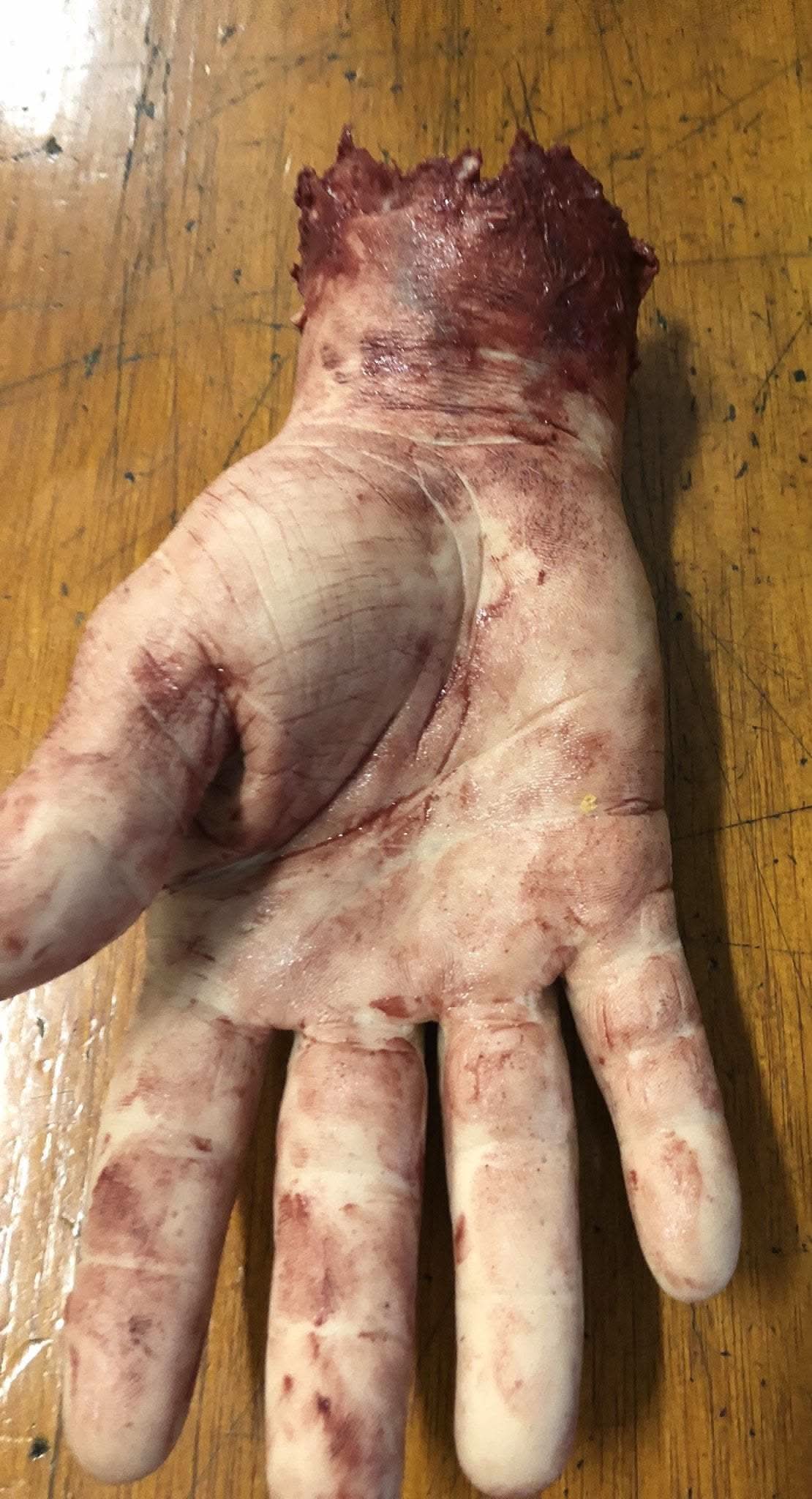 Thumb 2
