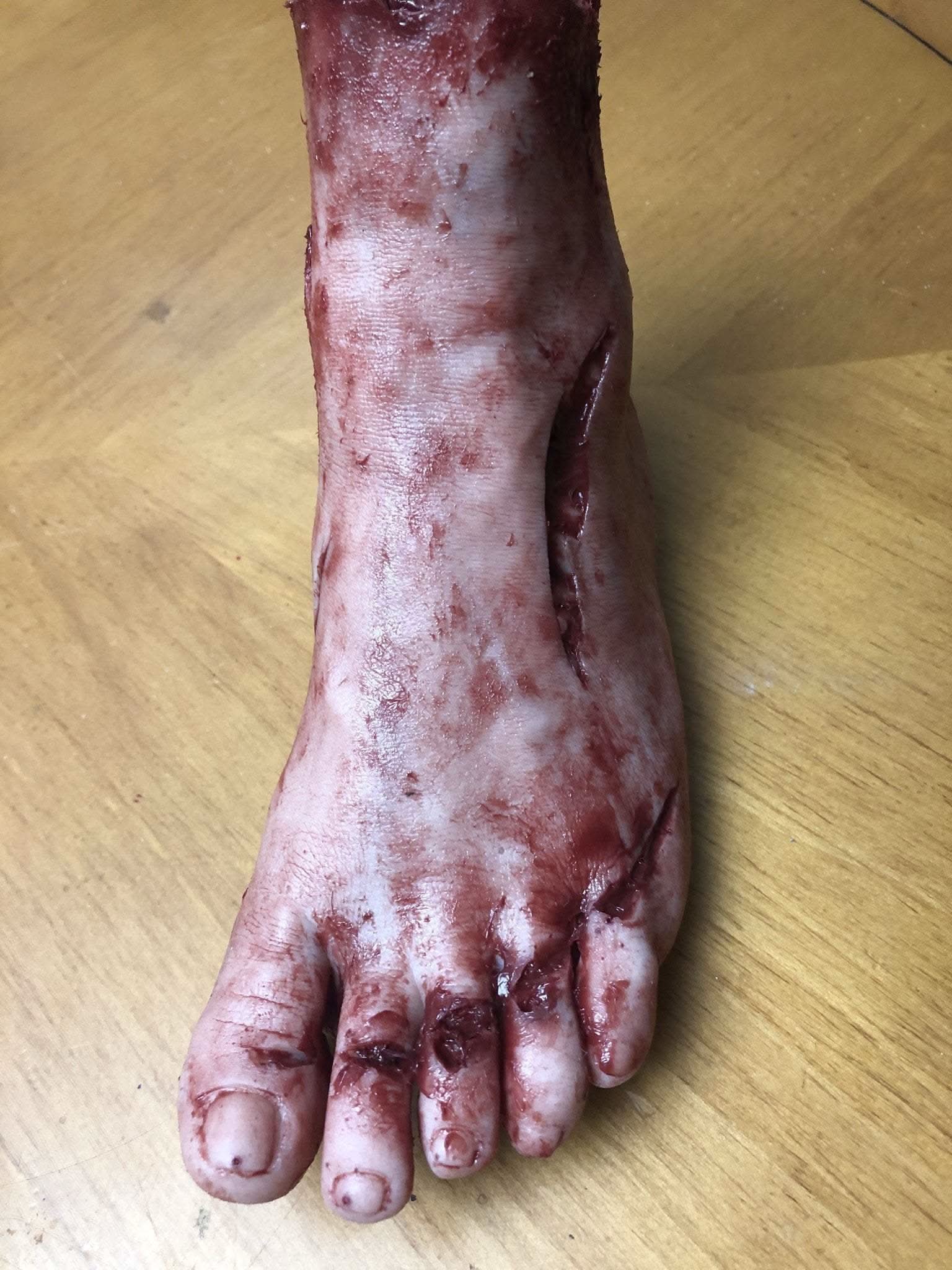 Thumb 2